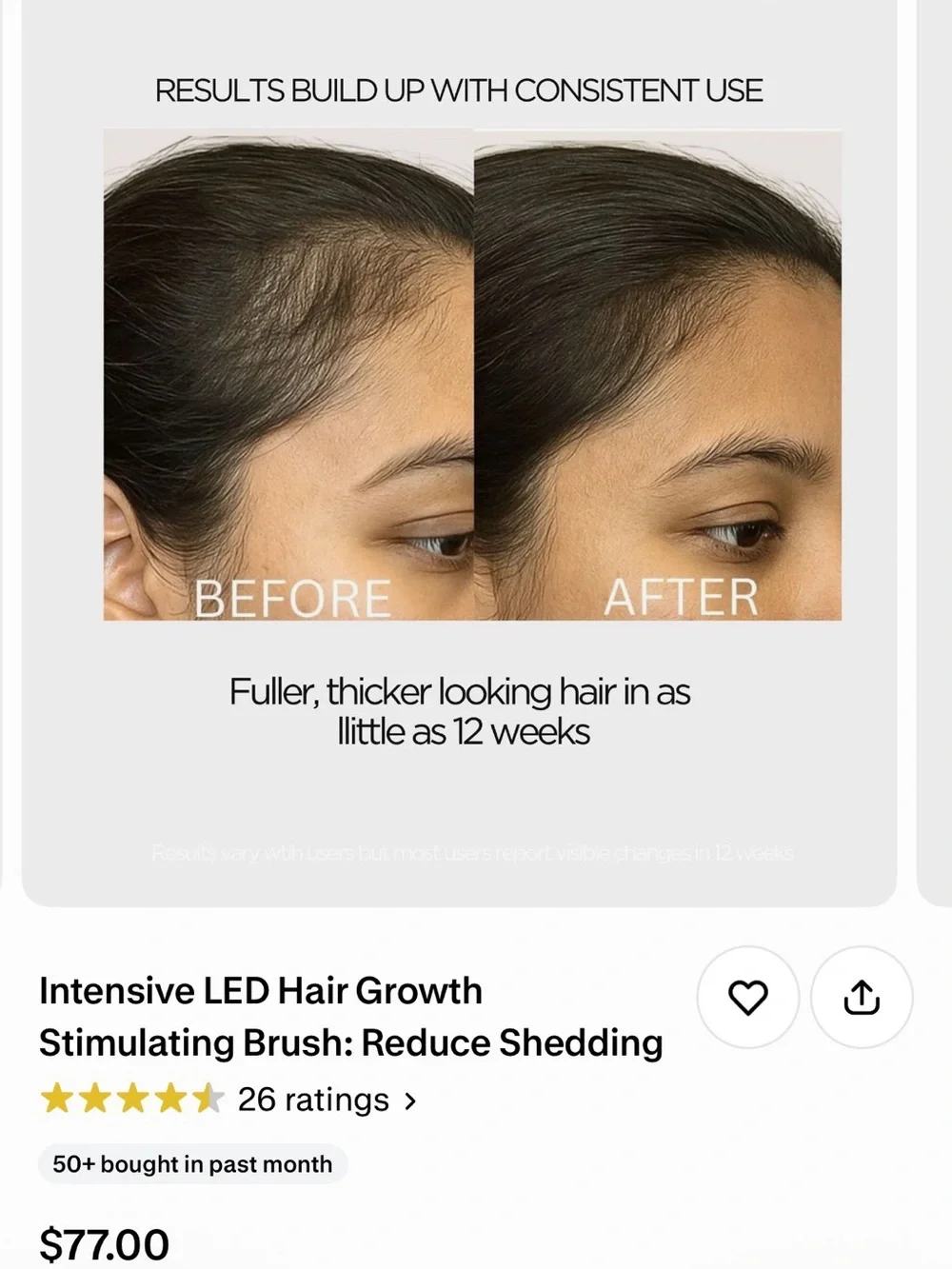 Solaris White Hair Growth Brush